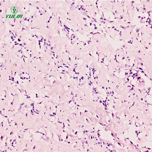 人肌肉骨骼系統(tǒng)疾病標本片