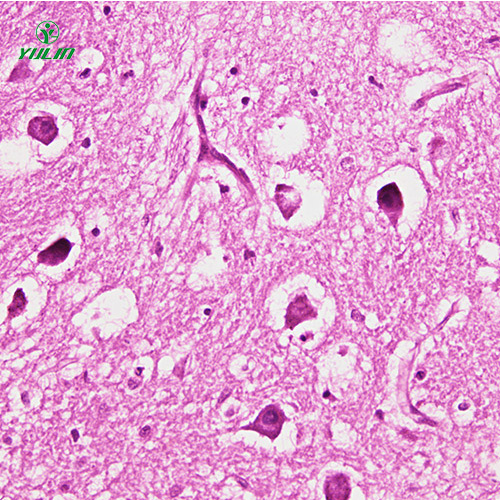 人神經系統(tǒng)疾病標本片