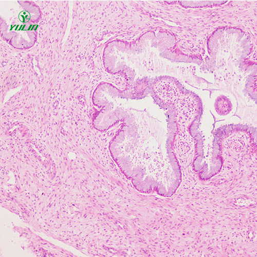 人泌尿生殖系統(tǒng)疾病標本片