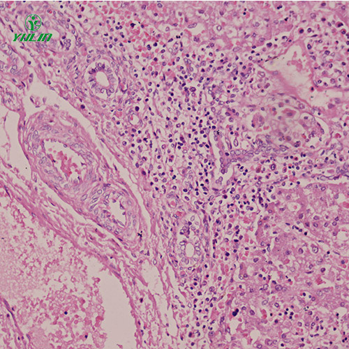 人消化系統(tǒng)疾病標本片