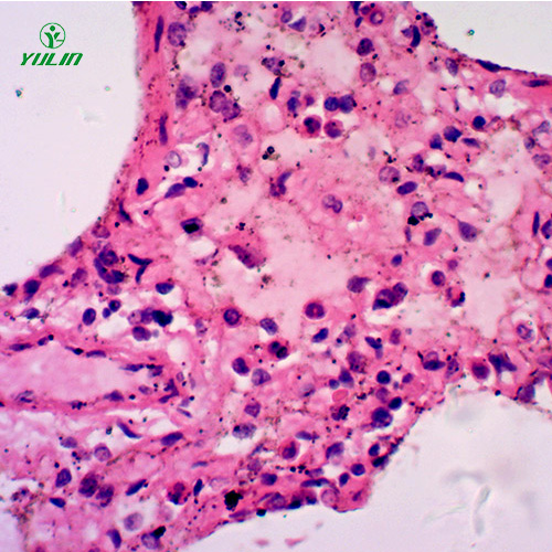 人呼吸系統(tǒng)疾病標本片