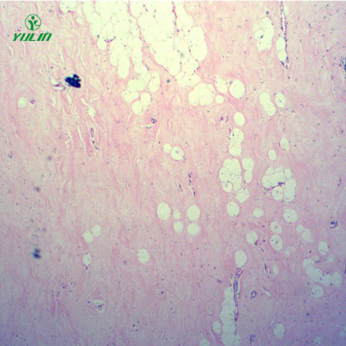 人體細胞組織損傷病理切片